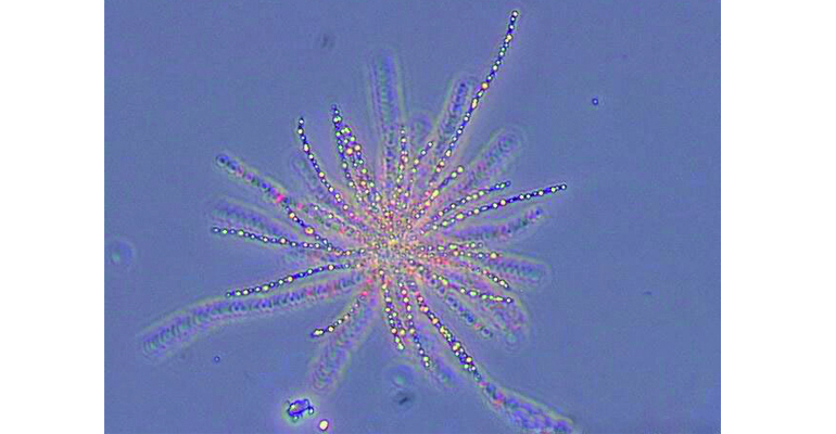 articulo-tecnico-microscopia-fisch-identificacion-bacterias-021n-thiothrix-fangos-activos