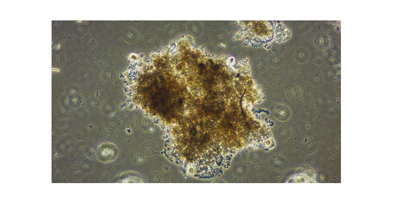 dtd-gbs-optimizan-edar-jamilena-microbiologia
