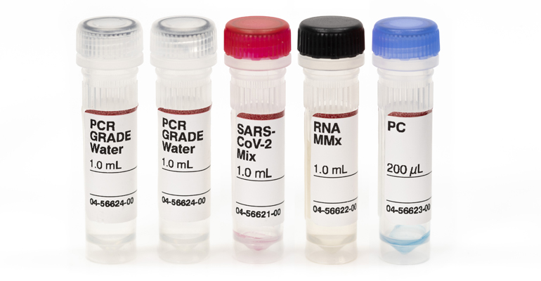 idexx-test-vigilancia-aguas-residuales-virus