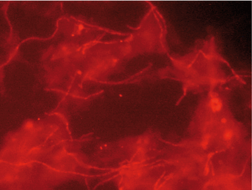 microscopia-convencional-fish-morfotipos-filamentosos-fangos-activos